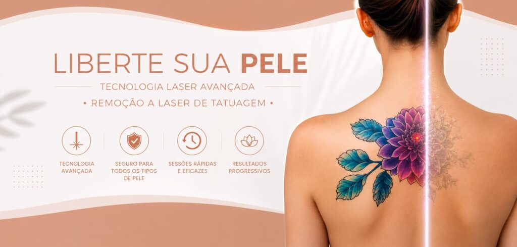 Remoção de tatuagem na DERMAClean no bairro Cariru em Ipatinga